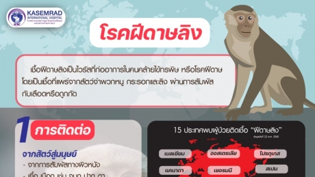 โรคฝีดาษลิง พบไม่บ่อย แต่อันตรายถึงชีวิต!!