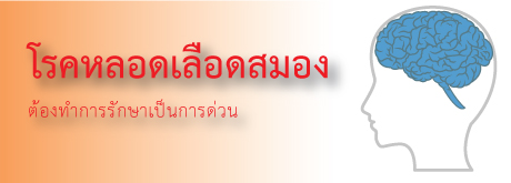 คุณหมอแจ้งอาการให้กับดิฉันว่าเป็น โรค Stroke