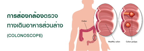 การส่องกล้องตรวจ ทางเดินอาหารส่วนล่าง (COLONOSCOPE)