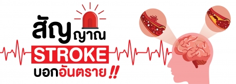 สัญญาณSTROKEบอกอันตราย