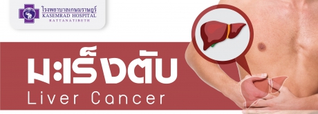 มะเร็งตับ