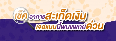 เช็คอาการด่วนเจอแบบนี้ใช่โรคสะเก็ดเงินไหมนะ