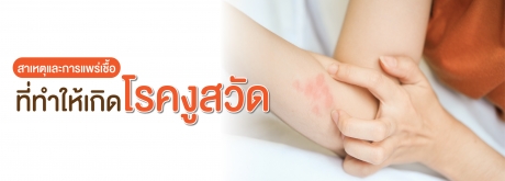 รู้ทันสาเหตุุและการแพร่เชื้อของโรคงูสวัด