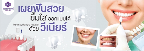 ฟันสวย มั่นใจ ทุกรอยยิ้ม ด้วย วีเนียร์